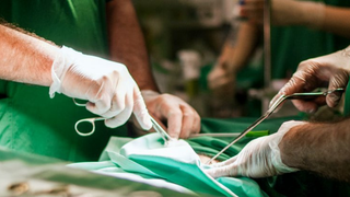 The First Human Head Transplant Will Take Place in 2017